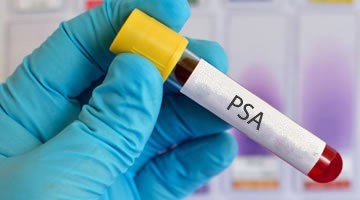 Animan a varones sanluisinos a realizarse examen prostático