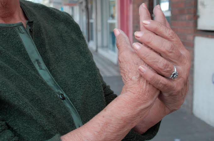 Promueven la  prevención de la osteoporosis entre los sanluisinos