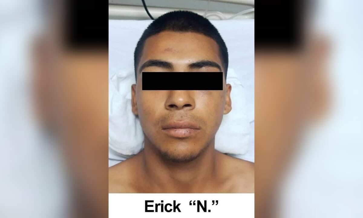 Sigue hospitalizado sicario que participo en la balacera del valle de SLRC